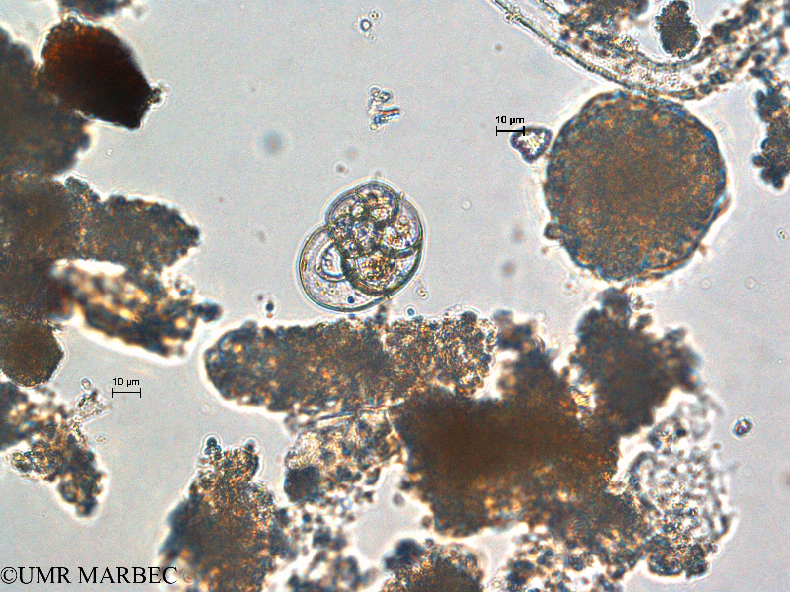 phyto/Scattered_Islands/europa/COMMA April 2011/Foraminifera spp (ancien Foraminifère 2 -2)(copy).jpg